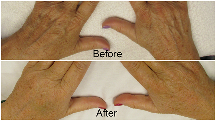 Heavenly Hands at Timeless Laser and Skin Care